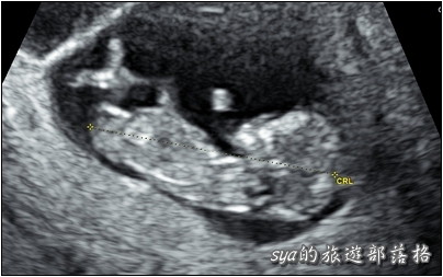 Baby in Car。求子之路 (試管療程、人工助孕、中醫調養、心路歷程)