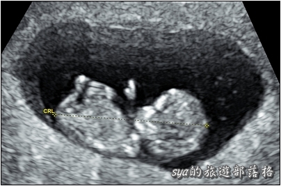 Baby in Car。求子之路 (試管療程、人工助孕、中醫調養、心路歷程)